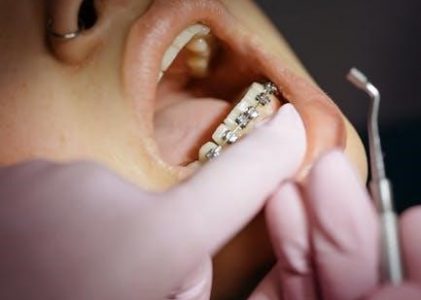 dental abbreviations pdf